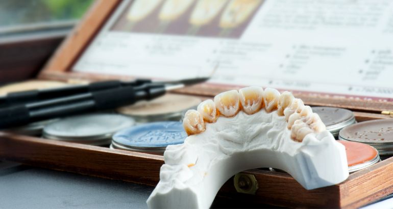 dental crown and bridges in chandigarh